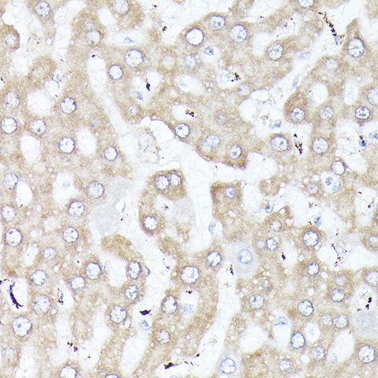 DBI Antibody in Immunohistochemistry (Paraffin) (IHC (P))