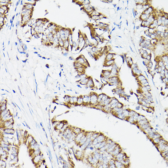 DLD Antibody in Immunohistochemistry (Paraffin) (IHC (P))