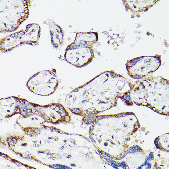 DLD Antibody in Immunohistochemistry (Paraffin) (IHC (P))