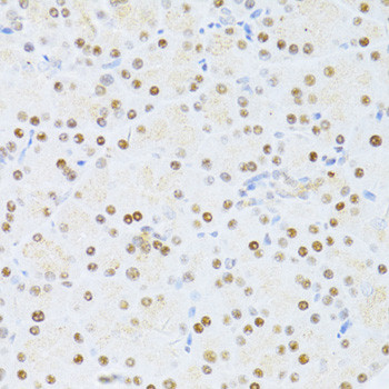 ETV1 Antibody in Immunohistochemistry (Paraffin) (IHC (P))