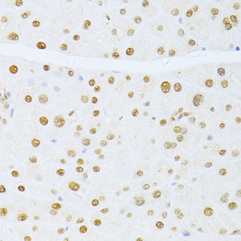 ETV1 Antibody in Immunohistochemistry (Paraffin) (IHC (P))