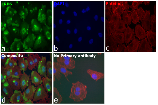 LRP6 Antibody in Immunocytochemistry (ICC/IF)