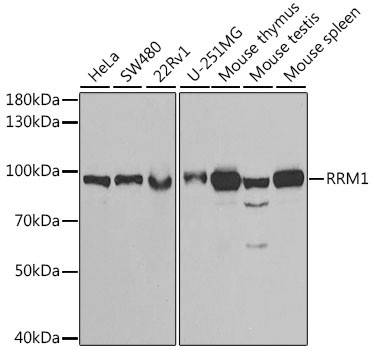 RRM1 Antibody in Western Blot (WB)