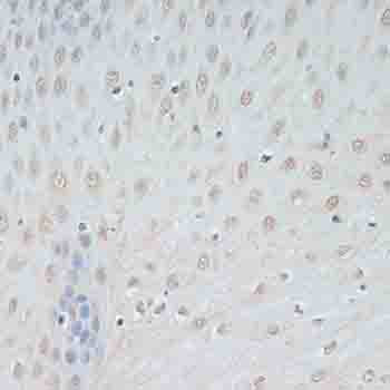 TCEB2 Antibody in Immunohistochemistry (Paraffin) (IHC (P))