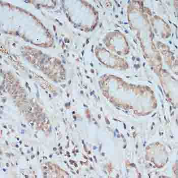 TCEB2 Antibody in Immunohistochemistry (Paraffin) (IHC (P))