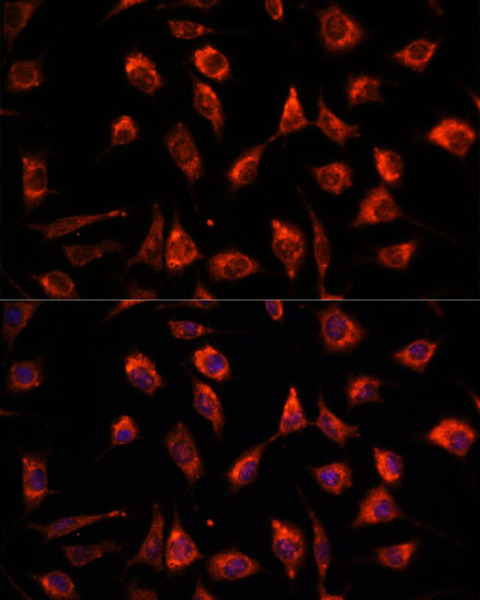 TPT1 Antibody in Immunocytochemistry (ICC/IF)