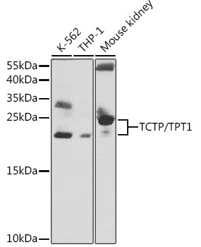 TPT1 Antibody in Western Blot (WB)