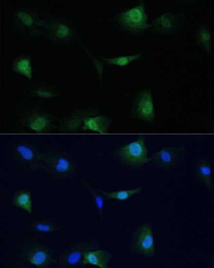 VCP Antibody in Immunocytochemistry (ICC/IF)