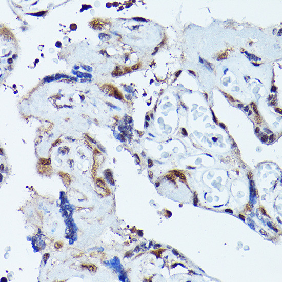 VCP Antibody in Immunohistochemistry (Paraffin) (IHC (P))