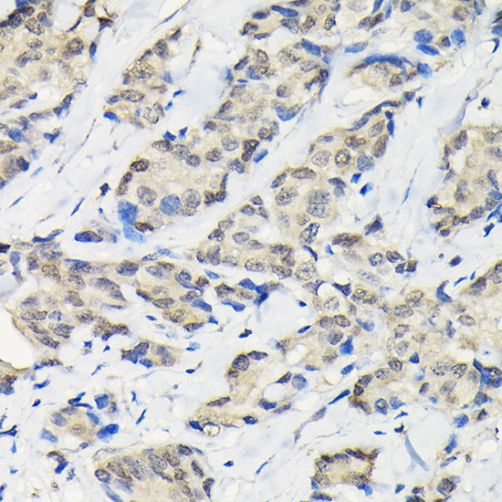 SSNA1 Antibody in Immunohistochemistry (Paraffin) (IHC (P))