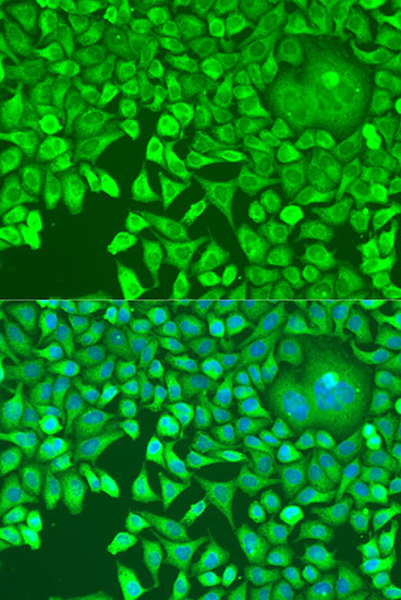 PUM1 Antibody in Immunocytochemistry (ICC/IF)