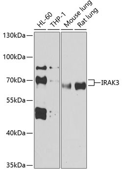 IRAK-M Antibody in Western Blot (WB)