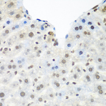 TDP-43 Antibody in Immunohistochemistry (Paraffin) (IHC (P))