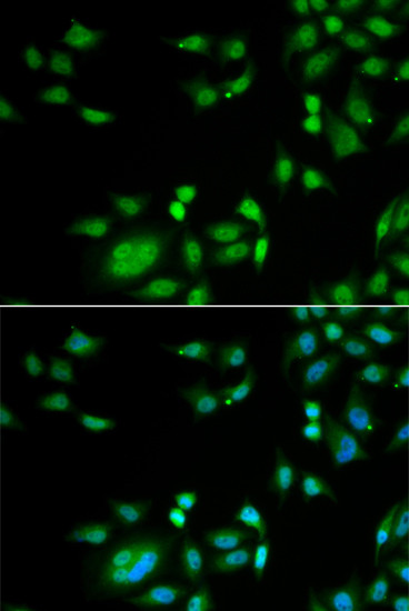 INTS10 Antibody in Immunocytochemistry (ICC/IF)