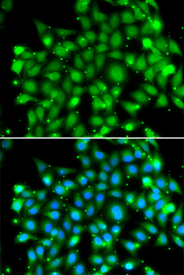 SUFU Antibody in Immunocytochemistry (ICC/IF)