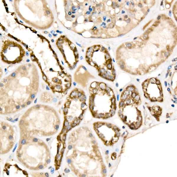 Cytochrome C Antibody in Immunohistochemistry (Paraffin) (IHC (P))