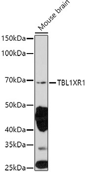 TBLR1 Antibody in Western Blot (WB)