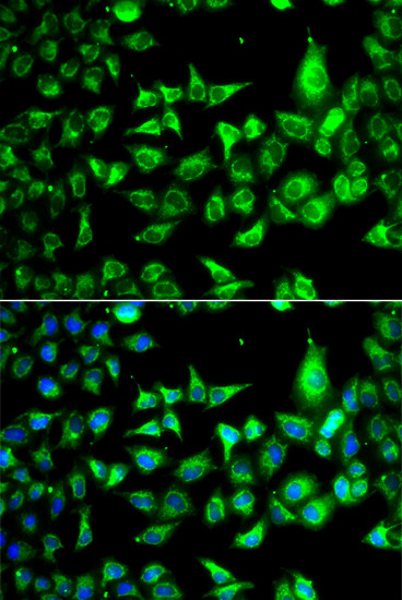 ACCS Antibody in Immunocytochemistry (ICC/IF)