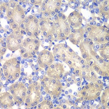 Aminoacylase Antibody in Immunohistochemistry (Paraffin) (IHC (P))