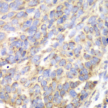 Aminoacylase Antibody in Immunohistochemistry (Paraffin) (IHC (P))