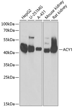 Aminoacylase Antibody in Western Blot (WB)