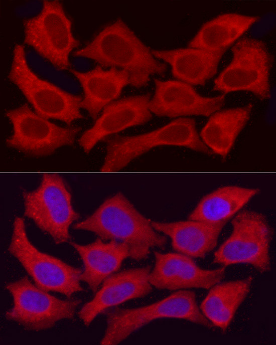 ADH5 Antibody in Immunocytochemistry (ICC/IF)