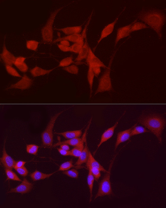 ADH5 Antibody in Immunocytochemistry (ICC/IF)