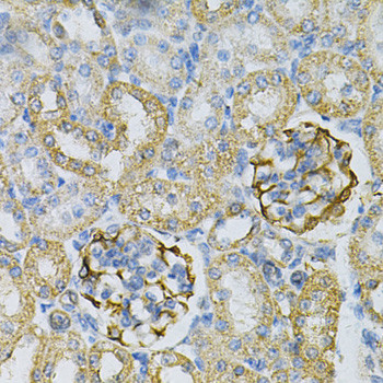 Adenylate Kinase 1 Antibody in Immunohistochemistry (Paraffin) (IHC (P))