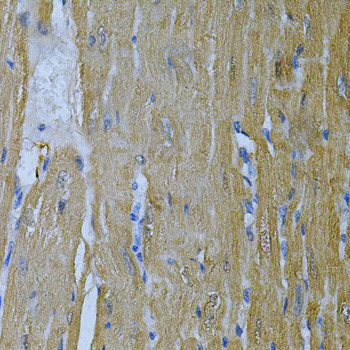 Adenylate Kinase 1 Antibody in Immunohistochemistry (Paraffin) (IHC (P))