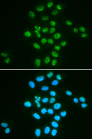 BMI-1 Antibody in Immunocytochemistry (ICC/IF)