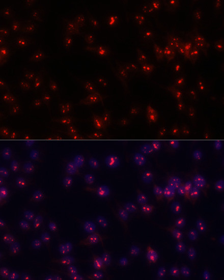 Fibrillarin Antibody in Immunocytochemistry (ICC/IF)