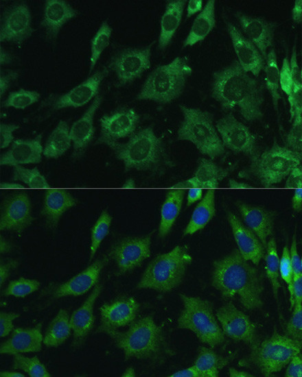 Galectin 3 Antibody in Immunocytochemistry (ICC/IF)