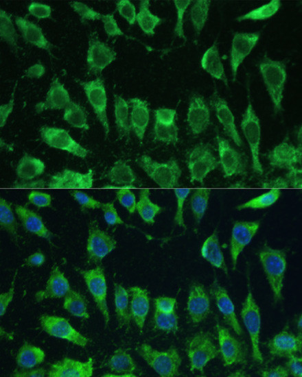 Galectin 3 Antibody in Immunocytochemistry (ICC/IF)