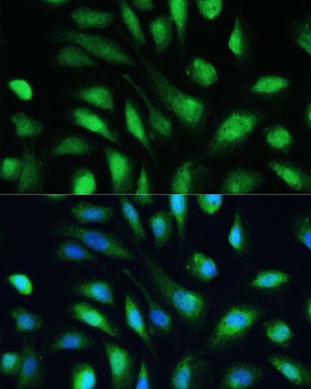 Galectin 3 Antibody in Immunocytochemistry (ICC/IF)