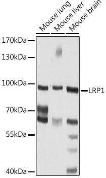 CD91 Antibody in Western Blot (WB)