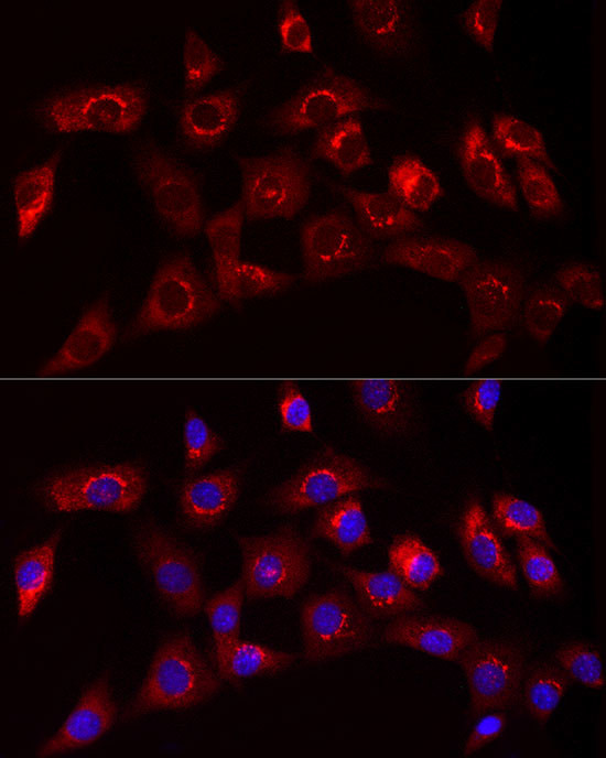 COL1A1 Antibody in Immunocytochemistry (ICC/IF)