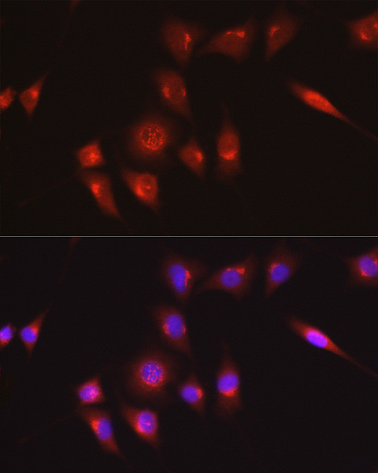 COL1A1 Antibody in Immunocytochemistry (ICC/IF)