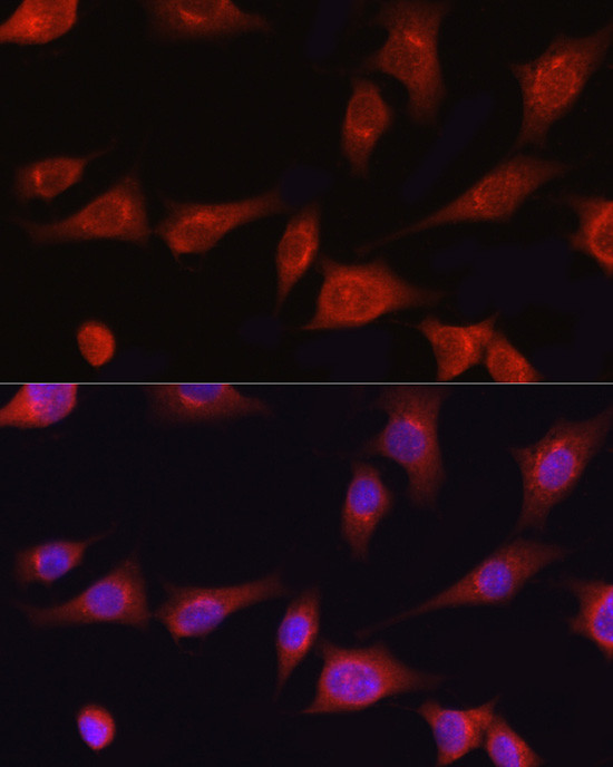 COL1A1 Antibody in Immunocytochemistry (ICC/IF)