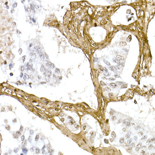 COL1A1 Antibody in Immunohistochemistry (Paraffin) (IHC (P))