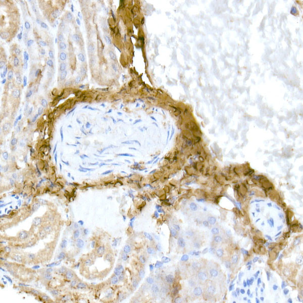 COL1A1 Antibody in Immunohistochemistry (Paraffin) (IHC (P))