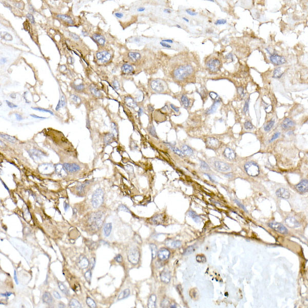 COL1A1 Antibody in Immunohistochemistry (Paraffin) (IHC (P))