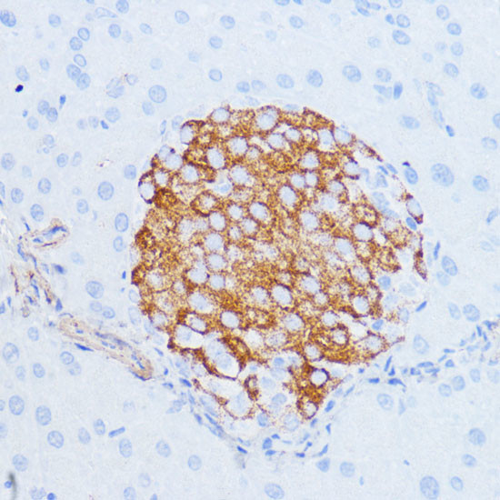 NOTCH3 Antibody in Immunohistochemistry (Paraffin) (IHC (P))