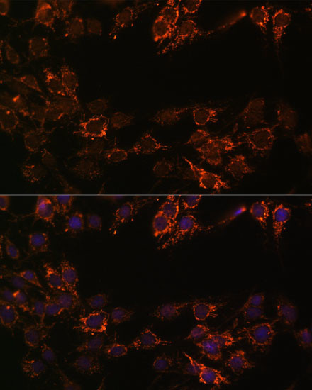 MAOA Antibody in Immunocytochemistry (ICC/IF)