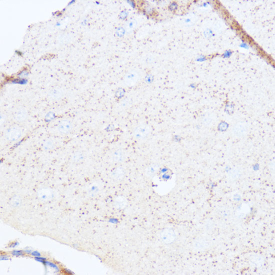 MAOA Antibody in Immunohistochemistry (Paraffin) (IHC (P))