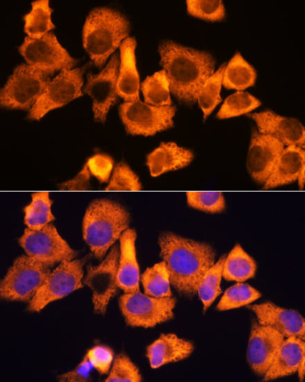 RPS3 Antibody in Immunocytochemistry (ICC/IF)