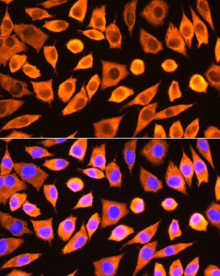 RPS3 Antibody in Immunocytochemistry (ICC/IF)