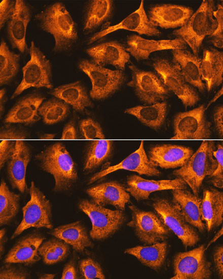 RPS3 Antibody in Immunocytochemistry (ICC/IF)