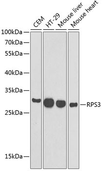 RPS3 Antibody in Western Blot (WB)