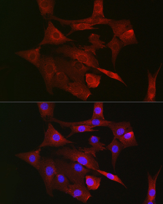 TFAM Antibody in Immunocytochemistry (ICC/IF)