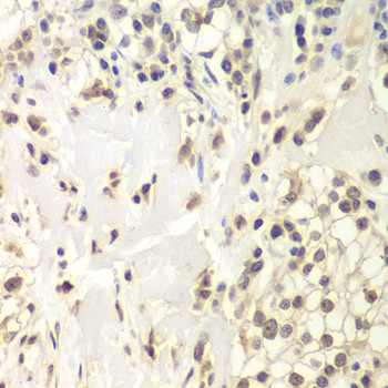 USP7 Antibody in Immunohistochemistry (Paraffin) (IHC (P))